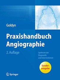 Praxishandbuch Angiographie - Gerd L. Goldyn - E-Book