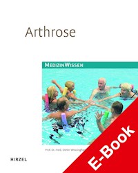 Arthrose - Dieter Wessinghage - E-Book