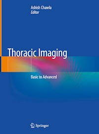 Thoracic Imaging -  - E-Book