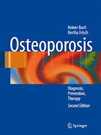 Osteoporosis - Reiner Bartl - E-Book