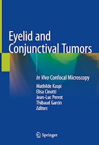 Eyelid and Conjunctival Tumors -  - E-Book