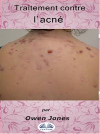 Traitement Contre L'Acné - Owen Jones - E-Book
