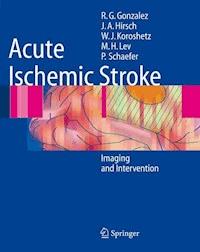 Acute Ischemic Stroke - R. Gilberto González - E-Book