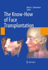 The Know-How of Face Transplantation - - E-Book