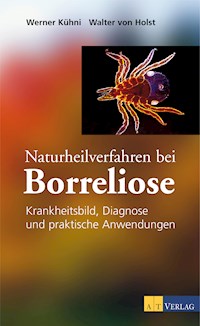 Naturheilverfahren bei Borreliose - eBook - Werner Kühni - E-Book