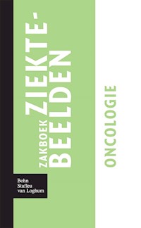 Zakboek ziektebeelden Oncologie - Karin Linden - E-Book