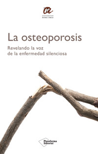 La osteoporosis - Varios autores - E-Book
