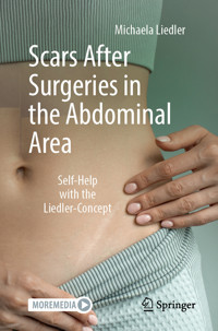 Scars After Surgeries in the Abdominal Area - Michaela Liedler - E-Book