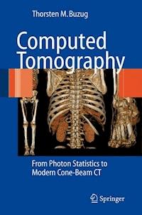 Computed Tomography - Thorsten M. Buzug - E-Book