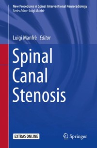 Spinal Canal Stenosis -  - E-Book