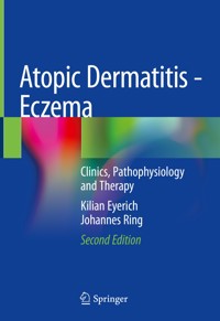 Atopic Dermatitis - Eczema - Kilian Eyerich - E-Book