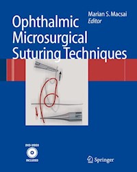 Ophthalmic Microsurgical Suturing Techniques -  - E-Book