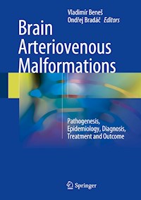 Brain Arteriovenous Malformations -  - E-Book