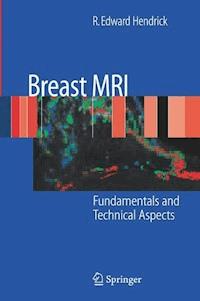 Breast MRI - R. Edward Hendrick - E-Book