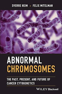 Abnormal Chromosomes - Sverre Heim - E-Book