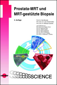Prostata-MRT und MRT-gestützte Biopsie - Dirk Blondin - E-Book