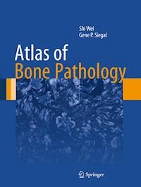 Atlas of Bone Pathology - Shi Wei - E-Book
