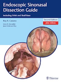 Endoscopic Sinonasal Dissection Guide - Roy R. Casiano - E-Book