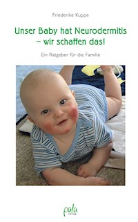 Unser Baby hat Neurodermitis - wir schaffen das! - Friederike Kuppe - E-Book