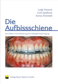 Die Aufbissschiene - Luigi Venanzi - E-Book