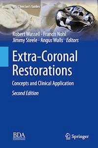 Extra-Coronal Restorations -  - E-Book