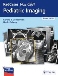 RadCases Plus Q&A Pediatric Imaging - Richard B. Gunderman - E-Book
