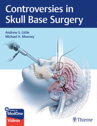 Controversies in Skull Base Surgery - Andrew S. Little - E-Book
