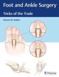 Foot and Ankle Surgery - Steven M. Raikin - E-Book
