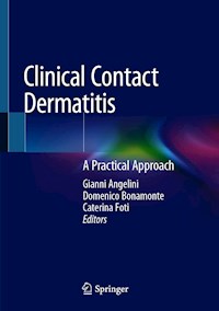 Clinical Contact Dermatitis -  - E-Book
