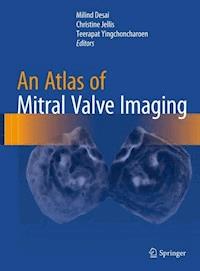 An Atlas of Mitral Valve Imaging -  - E-Book