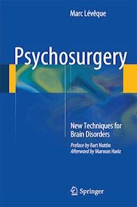 Psychosurgery - Marc Lévêque - E-Book