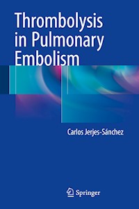 Thrombolysis in Pulmonary Embolism - Carlos Jerjes-Sánchez - E-Book