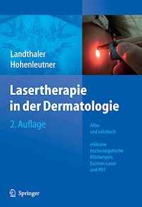 Lasertherapie in der Dermatologie - Michael Landthaler - E-Book