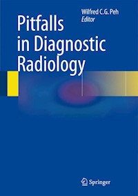 Pitfalls in Diagnostic Radiology -  - E-Book