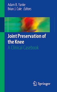 Joint Preservation of the Knee -  - E-Book