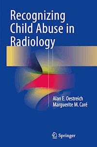 Recognizing Child Abuse in Radiology - Alan E. Oestreich - E-Book