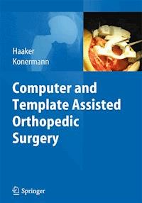 Computer and Template Assisted Orthopedic Surgery -  - E-Book