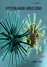 Epstein-Barr-Virus (EBV) - Joachim Strienz - E-Book