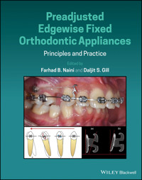 Preadjusted Edgewise Fixed Orthodontic Appliances -  - E-Book