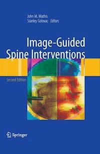 Image-Guided Spine Interventions -  - E-Book