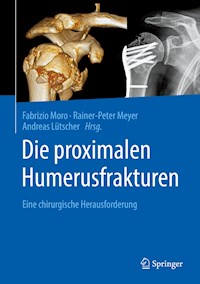 Die proximalen Humerusfrakturen -  - E-Book