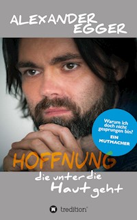 Hoffnung die unter die Haut geht - Alexander Egger - E-Book