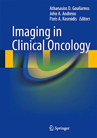 Imaging in Clinical Oncology -  - E-Book