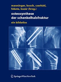 Osteosynthese der Schenkelhalsfraktur -  - E-Book