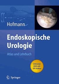 Endoskopische Urologie -  - E-Book