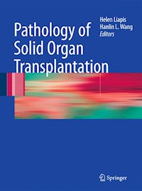 Pathology of Solid Organ Transplantation -  - E-Book