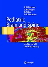 Pediatric Brain and Spine - L.M. Ketonen - E-Book
