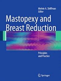Mastopexy and Breast Reduction -  - E-Book