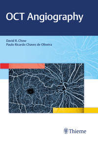 OCT Angiography - David Chow - E-Book
