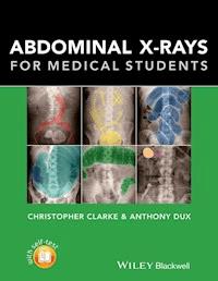 Abdominal X-rays for Medical Students - Christopher Clarke - E-Book